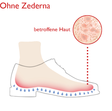 Zedernsohlen für natürlich gesunde Füße - der Zederna-Effekt